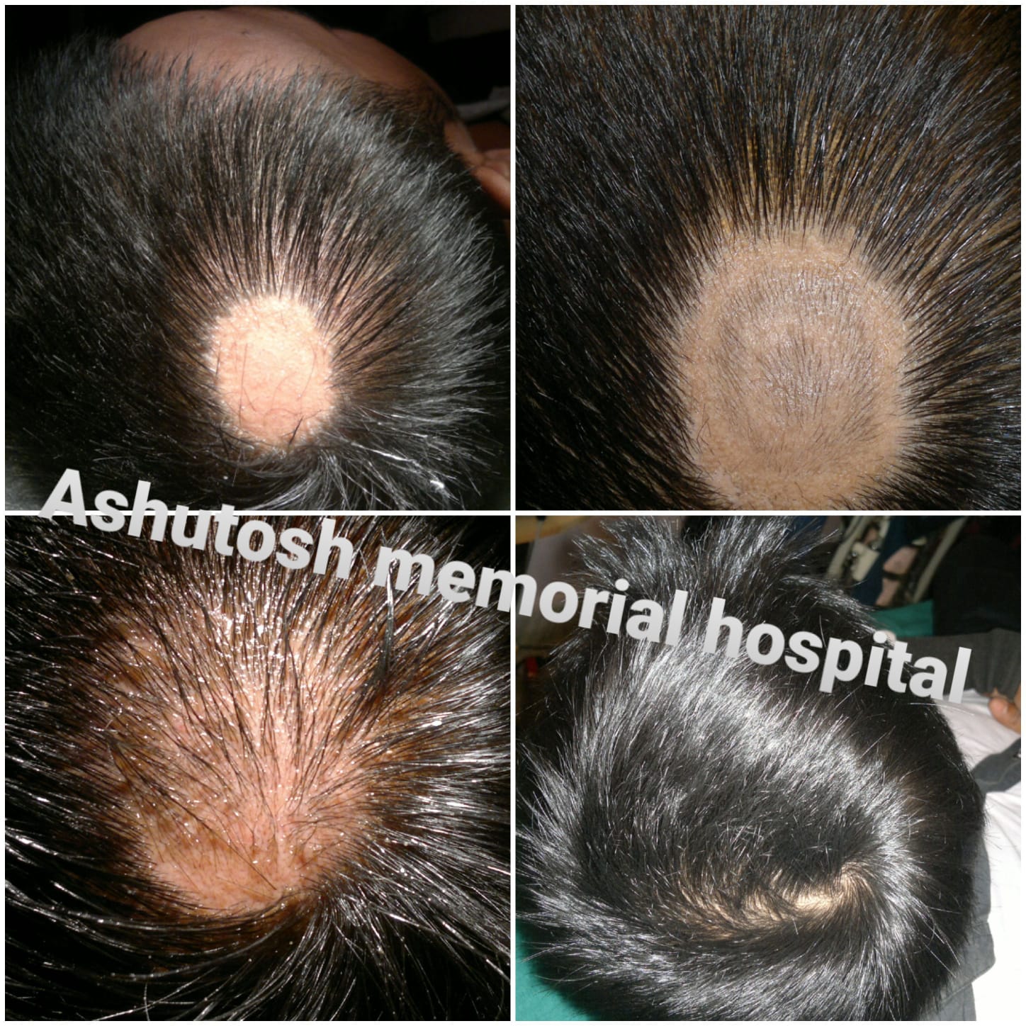 Dr. Paul's Patna | Patna